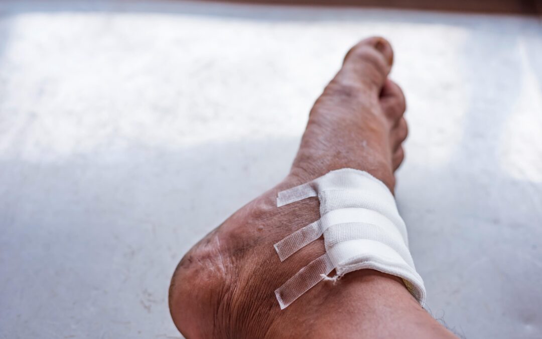 How to Treat a Chronic Wound?