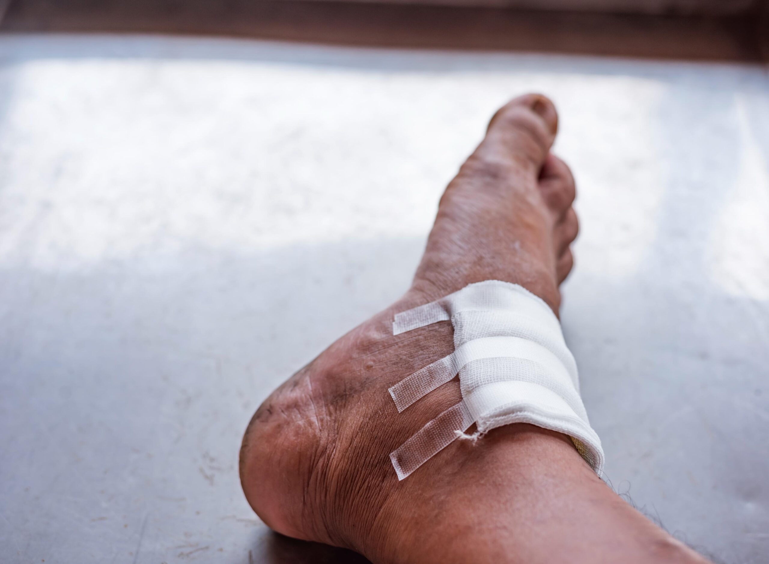 Chronic Wound